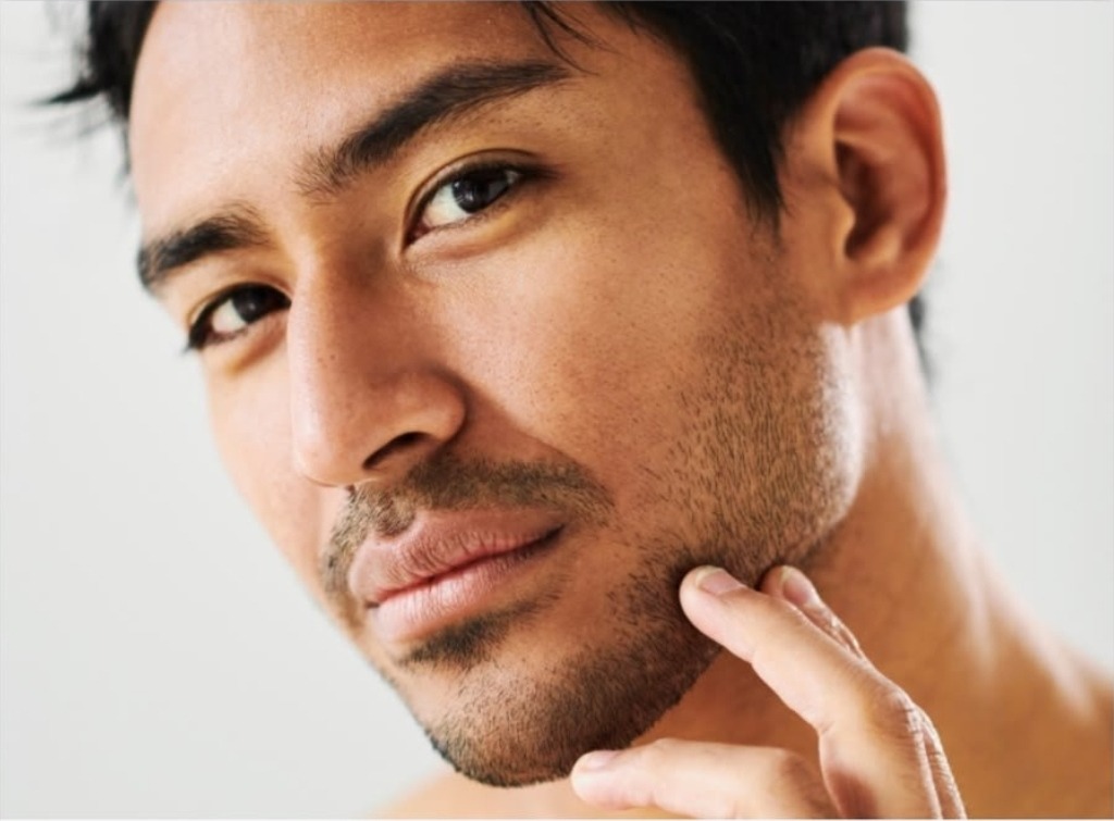 Laser resurfacing